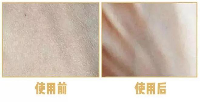 不涂身体乳身体会有多大差别？AG真人登录坚持涂 vs(图2)