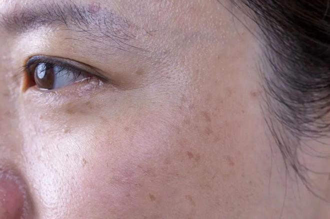 在雪场被晒得很曼妙AG真人不知道我(图3)